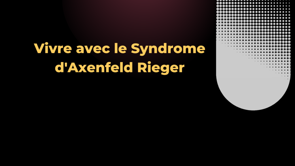 Syndrome d'Axenfeld Rieger | 4 Points Important